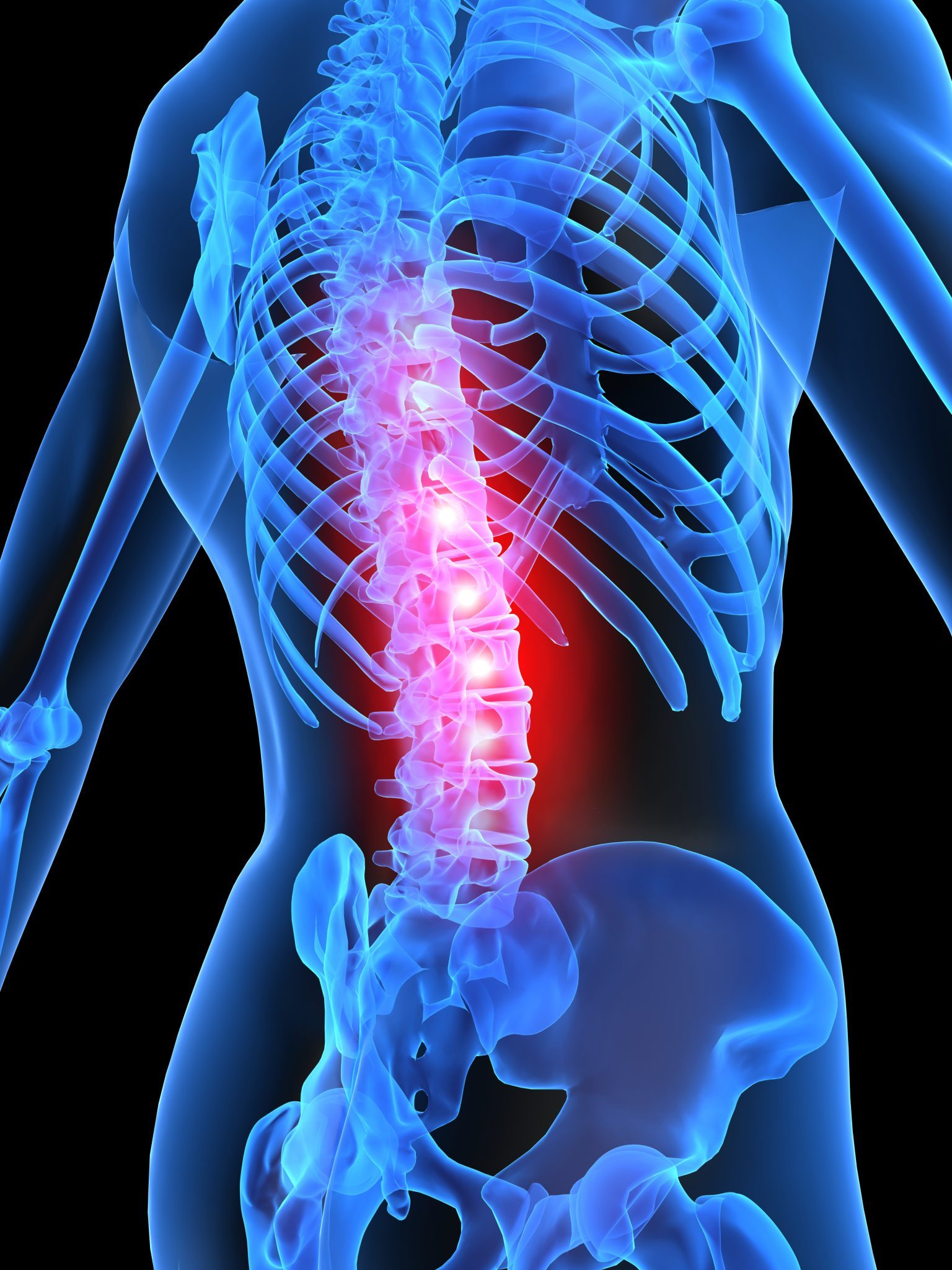 Is Your Back Pain Just Arthritis? Posturepro Physio